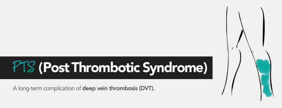 PTS (Post Thrombotic Syndrome)